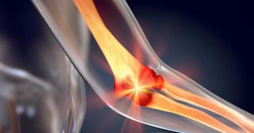 Futbolunuz eksikse, bu hastalıkları alabilirsiniz! Kalsiyum eksikliğinde görülen hastalıklar nelerdir? Hangi hastalıklar kalsiyum eksikliğine neden olur?