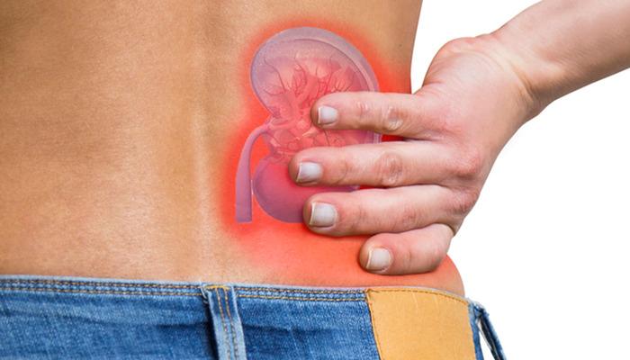 Renalistler sadece yetişkinlerin sorunu değildir: her yaşta görülebilir! Uzmanlar risklerden uyardı …