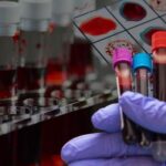 Dünyada yalnızca 50 kişide bulunan ‘altın kan’ laboratuvar ortamında üretilebilir mi?